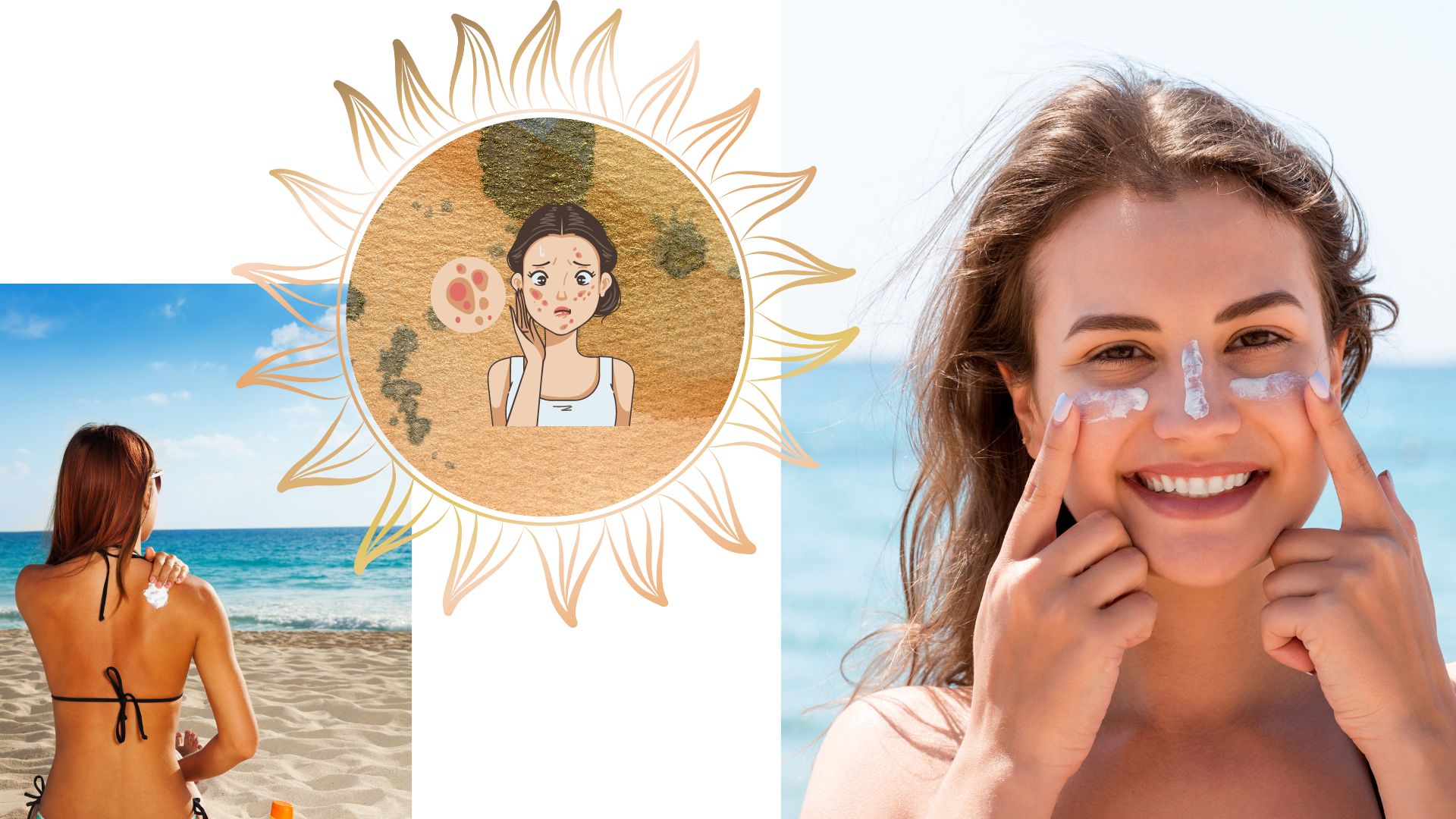 Acné, système immunitaire, vitamine D… : les 5 fausses idées reçues les plus répandues sur le bronzage au soleil !